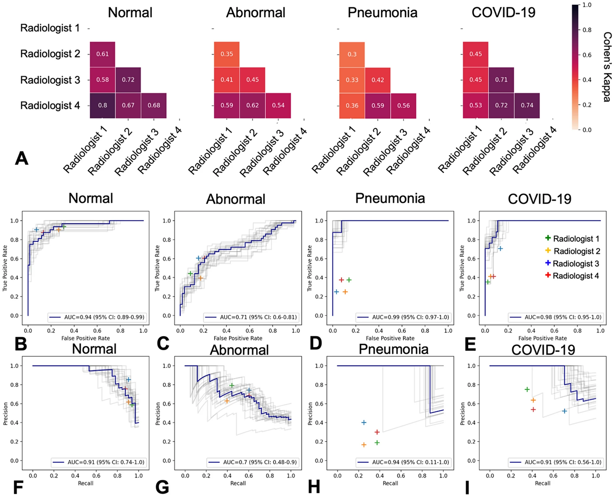 COVID-19 detection